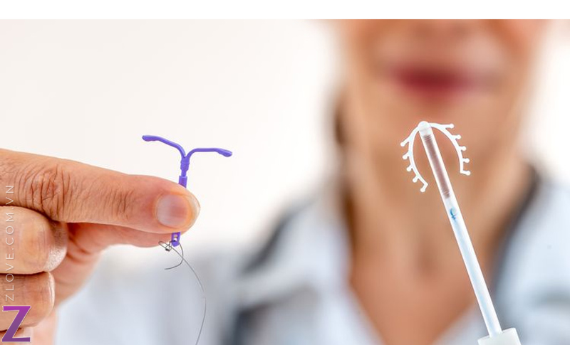 đặt vòng tháo vòng tránh thai có gây rối loạn kinh nguyệt không? | Zlove