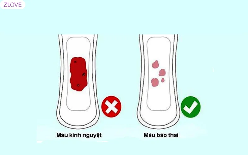 máu báo thai và máu kinh nguyệt