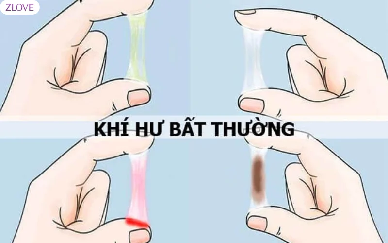 Ra máu vùng kín và khí hư có màu thất thường
