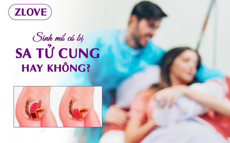 sa-tu-cung-sau-sinh-mo-2